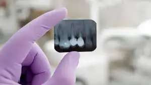 PELICULAS PARA RADIOGRAFIA DENTAL